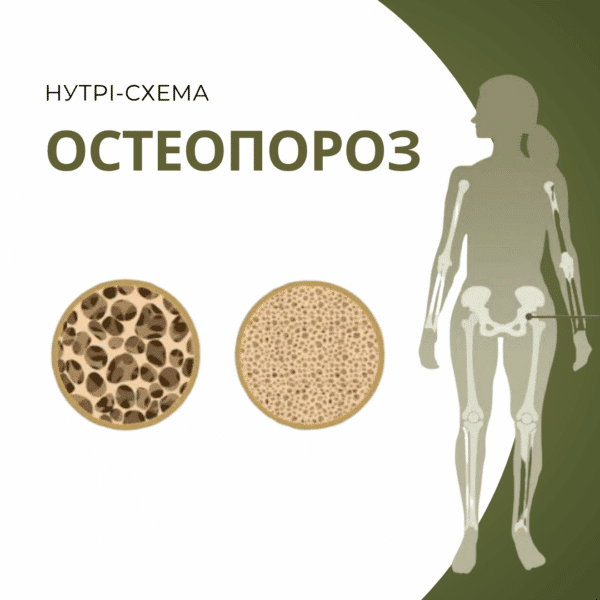 Нутрі-Схема “Остеопороз”